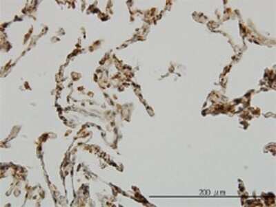 Immunohistochemistry-Paraffin: E6AP/UBE3A Antibody (2F6) [H00007337-M01]
