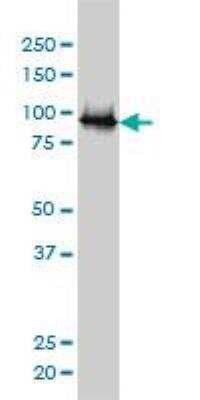 Western Blot: E6AP/UBE3A Antibody (2F6) [H00007337-M01]