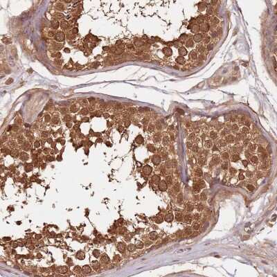Immunohistochemistry: E6AP/UBE3A Antibody [NBP2-38463]
