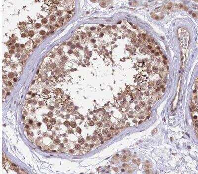 Immunohistochemistry-Paraffin: E6AP/UBE3A Antibody [NBP1-89092]