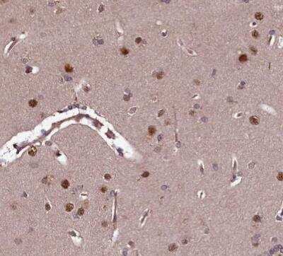 Immunohistochemistry-Paraffin: E6AP/UBE3A Antibody [NBP1-89092]