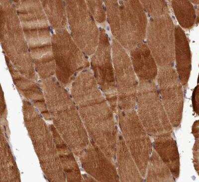 Immunohistochemistry-Paraffin: E6AP/UBE3A Antibody [NBP1-89092]