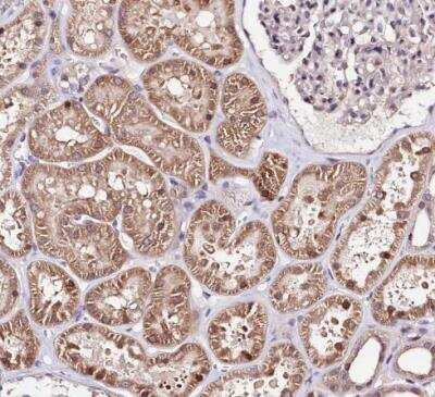 Immunohistochemistry-Paraffin: E6AP/UBE3A Antibody [NBP1-89092]