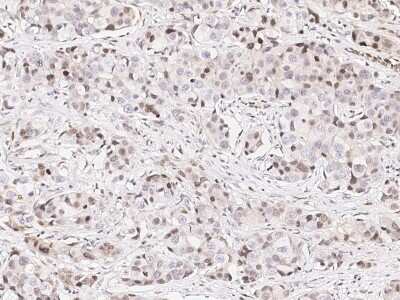 Immunohistochemistry-Paraffin: E6AP/UBE3A Antibody [NBP2-98953]