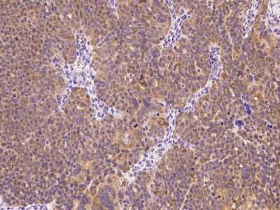 Immunohistochemistry-Paraffin: E6AP/UBE3A Antibody [NBP2-99342]