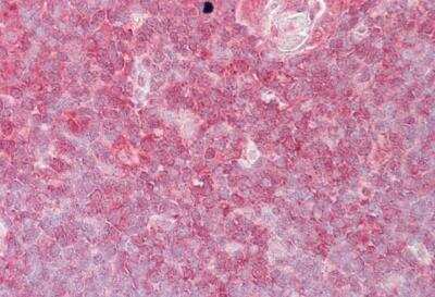 Immunohistochemistry-Paraffin: E74 like factor 1 Antibody [NB100-1069]