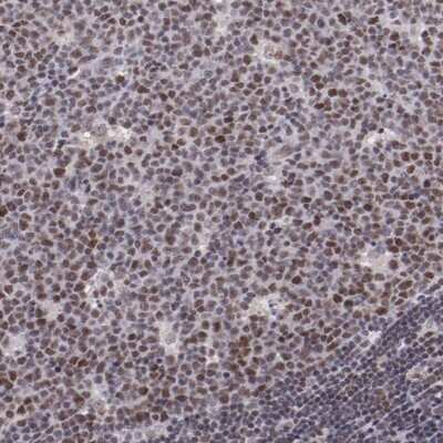 Immunohistochemistry-Paraffin: E74 like factor 1 Antibody [NBP1-90352]