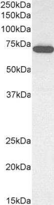 Western Blot: E74 like factor 1 Antibody [NB100-1069]
