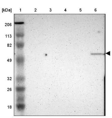 Western Blot: E74 like factor 1 Antibody [NBP1-90352]