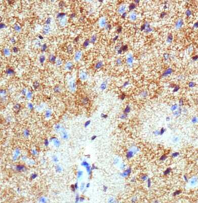 Immunohistochemistry-Paraffin: EAAT1/GLAST-1/SLC1A3 Antibody - BSA Free [NB100-1869]