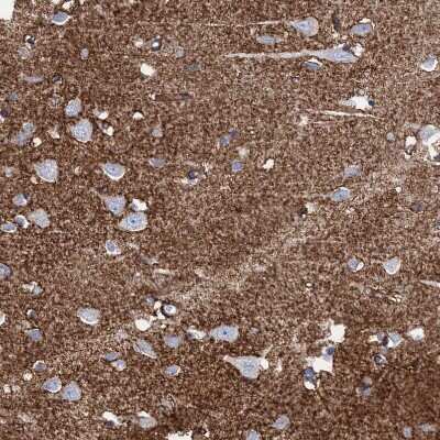 Immunohistochemistry-Paraffin: EAAT1/GLAST-1/SLC1A3 Antibody [NBP1-84939]
