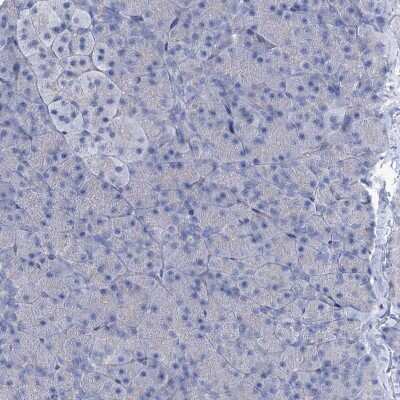 Immunohistochemistry-Paraffin: EAAT1/GLAST-1/SLC1A3 Antibody [NBP1-84939]