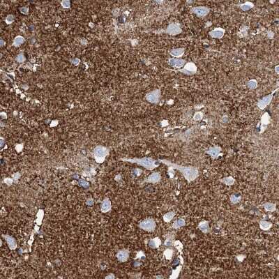 Immunohistochemistry-Paraffin: EAAT1/GLAST-1/SLC1A3 Antibody [NBP1-84940]