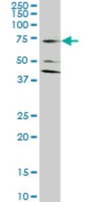 Western Blot: EAAT2/GLT1 Antibody (1D8) [H00006506-M07]