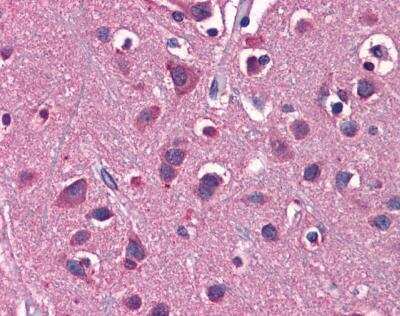 Immunohistochemistry-Paraffin: EAAT2/GLT1 Antibody [NBP1-59632]