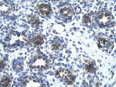 Immunohistochemistry-Paraffin: EAAT2/GLT1 Antibody [NBP1-59632]