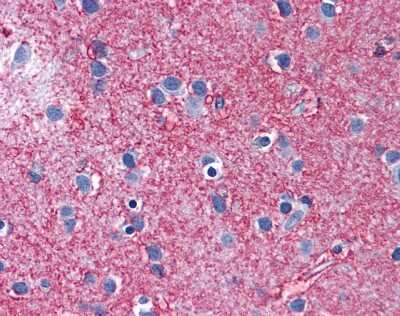 Immunohistochemistry-Paraffin: EAAT2/GLT1 Antibody [NBP1-59633]