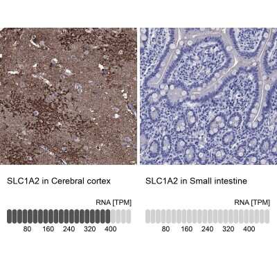 Immunohistochemistry-Paraffin: EAAT2/GLT1 Antibody [NBP3-17032]