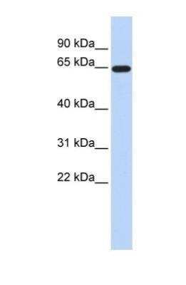 Western Blot: EAAT2/GLT1 Antibody [NBP1-59632]