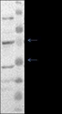 Western Blot: EAAT2/GLT1 Antibody [NBP1-59632]
