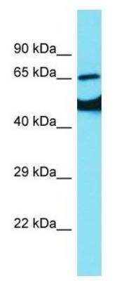 Western Blot: EAAT2/GLT1 Antibody [NBP1-59632]