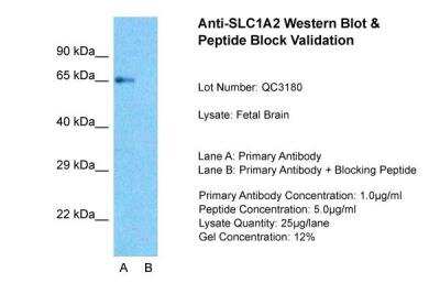 Western Blot: EAAT2/GLT1 Antibody [NBP1-59632]