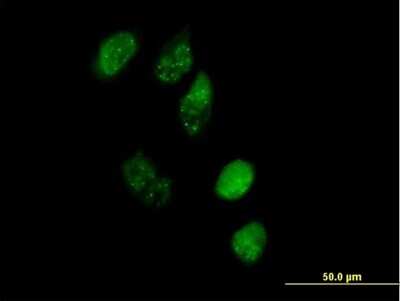 Immunocytochemistry/ Immunofluorescence: EAF1 Antibody [H00085403-B01P]