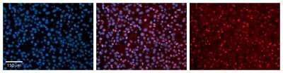 Immunohistochemistry-Paraffin: EAR2/NR2F6 Antibody [NBP2-86623]
