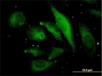 Immunocytochemistry/ Immunofluorescence: EB2 Antibody (4D7) [H00010982-M03]