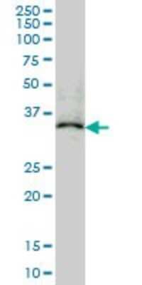 Western Blot: EB2 Antibody (4D7) [H00010982-M03]