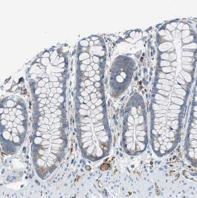 Immunohistochemistry-Paraffin: EB2 Antibody [NBP1-84926]