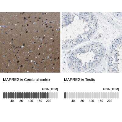 Immunohistochemistry-Paraffin: EB2 Antibody [NBP1-84927]