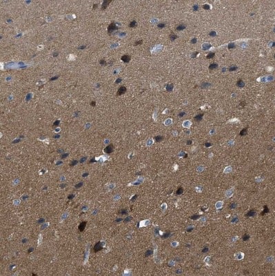Immunohistochemistry-Paraffin: EB2 Antibody [NBP1-84927]