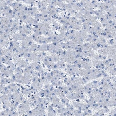 Immunohistochemistry-Paraffin: EB2 Antibody [NBP1-84927]