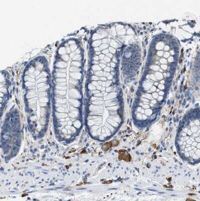 Immunohistochemistry-Paraffin: EB2 Antibody [NBP1-84927]