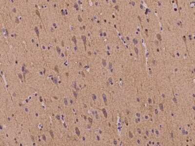 Immunohistochemistry-Paraffin: EB2 Antibody [NBP2-98106]