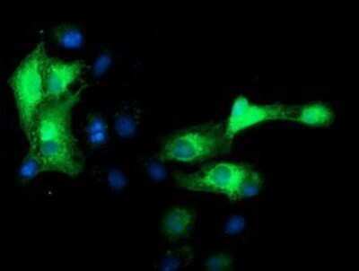 Immunocytochemistry/ Immunofluorescence: EB2 Antibody (OTI1F3) - Azide and BSA Free [NBP2-71650]
