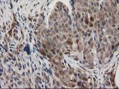 Immunohistochemistry: EB2 Antibody (OTI1F3) - Azide and BSA Free [NBP2-71650]