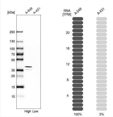 Western Blot: EB2 Antibody [NBP1-84926]
