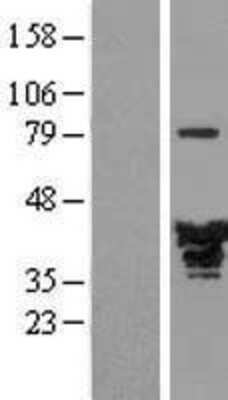 Western Blot: EB2 Overexpression Lysate [NBL1-12892]