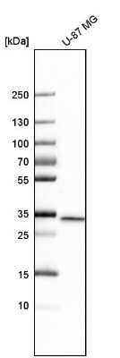 Western Blot: EB3 Antibody [NBP1-84924]