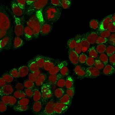Immunocytochemistry/ Immunofluorescence: EBAG9/RCAS1 Antibody (CPTC-EBAG9-1) - Azide and BSA Free [NBP3-08859]
