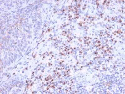 Immunohistochemistry-Paraffin: EBAG9/RCAS1 Antibody (CPTC-EBAG9-1) [NBP3-07534]