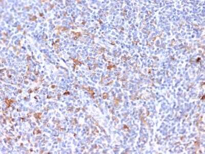 Immunohistochemistry-Paraffin: EBAG9/RCAS1 Antibody (CPTC-EBAG9-2) - Azide and BSA Free [NBP3-08860]