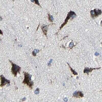 Immunohistochemistry-Paraffin: EBAG9/RCAS1 Antibody [NBP1-84922]