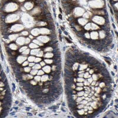 Immunohistochemistry-Paraffin: EBAG9/RCAS1 Antibody [NBP1-84922]
