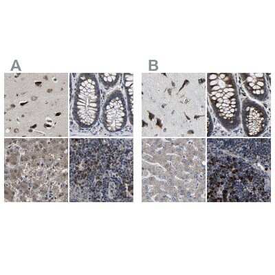 Immunohistochemistry-Paraffin: EBAG9/RCAS1 Antibody [NBP1-84923]