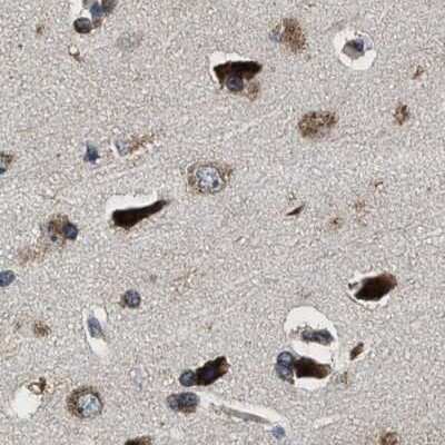 Immunohistochemistry-Paraffin: EBAG9/RCAS1 Antibody [NBP1-84923]