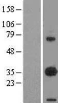 Western Blot: EBAG9/RCAS1 Overexpression Lysate [NBP2-04739]
