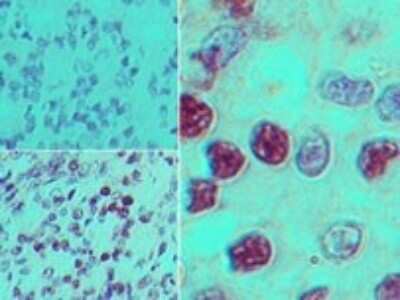 Immunohistochemistry-Paraffin: EBI2/GPR183 Antibody [NBP2-27352]